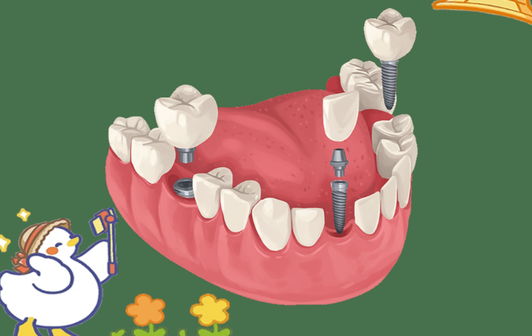 诺贝川口腔在种植牙领域具有明显优势