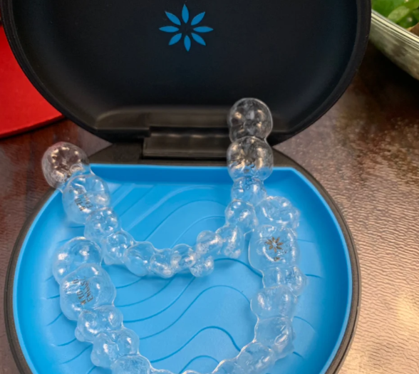 隐适美国产和进口版本详细对比分析