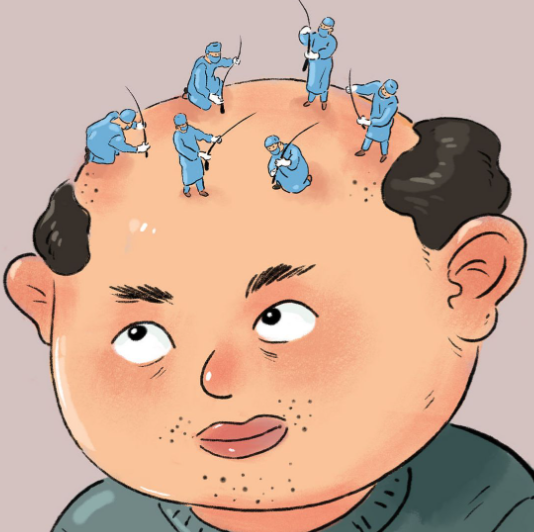 医生亲授3种科学防脱方案