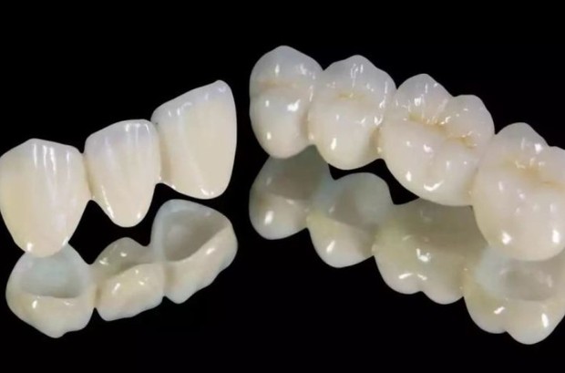 全瓷牙套这两年价格有下降吗？国产进口价格差异揭晓，低至100元起