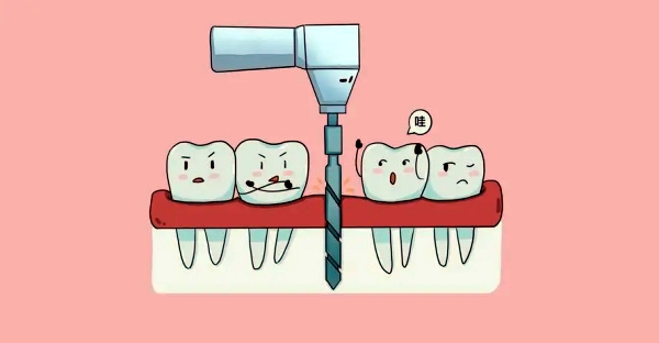 大清西格种植牙核心优势