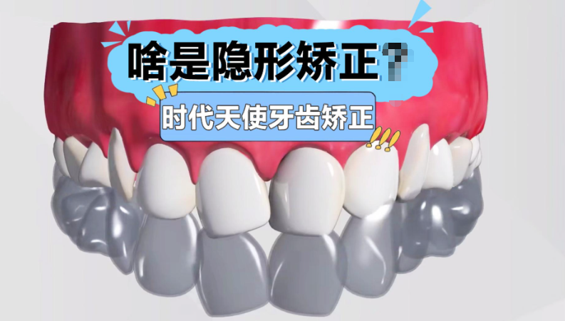 时代天使儿童版为下颌后缩提供了阶梯化解决方案