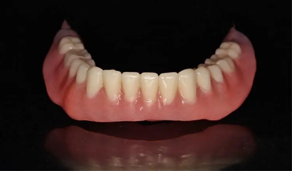 舟山吸附性全口义齿价格公开的优势