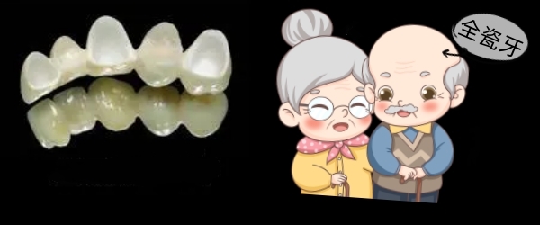 全瓷牙适合人群
