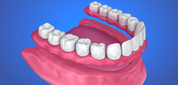 海口吸附性义齿收费明细的优势特点
