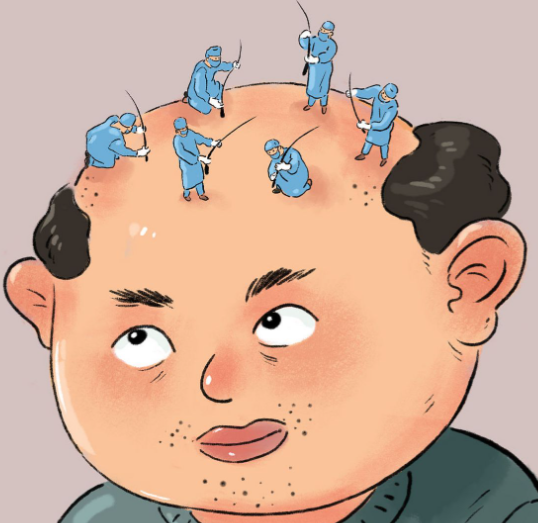 福州海峡整形医院植发值得选择吗？