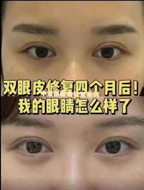 士卓曼BLT和BLX价格区别揭秘：BLT价格11800-18000元、BLX在14800-21000元，BLX比BLT贵3000-5000元