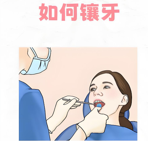 七、德国精密覆盖义齿有哪些局限性