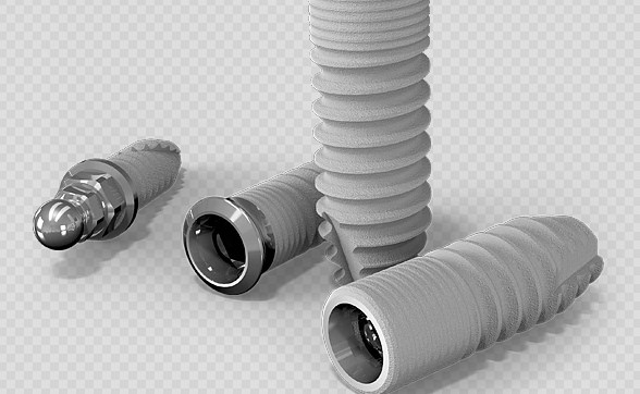 2025种植牙内部价格表大全：不同品牌与项目的真实收费