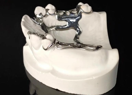 一、德国精密覆盖义齿是什么意思？其定义与原理是怎样的