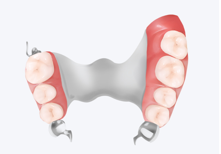 舟山做活动假牙哪家医院好？本地人常选的10家机构榜单，含纯钛假牙项目