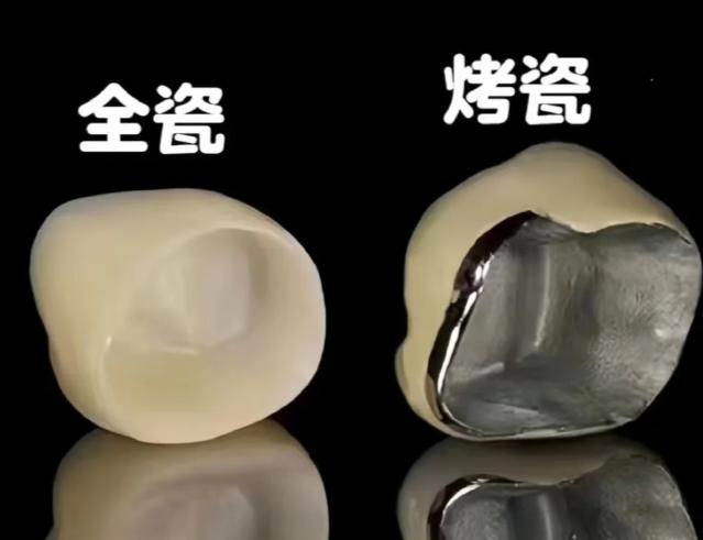 义佳烤瓷牙多少钱一颗？2025年新报价1500元起，适合预算有限人群