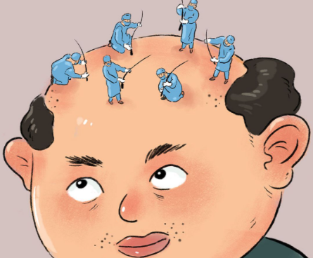 重庆植发哪里便宜靠谱