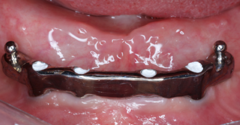 专门建议与选择要点