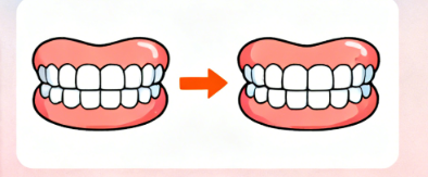 可丽尔隐形矫正