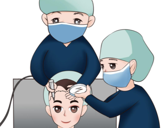 成都碧莲盛植发选择建议