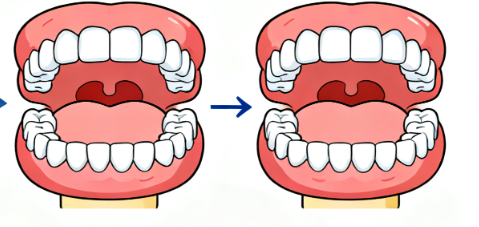 矫正偏颌是不是骗人的