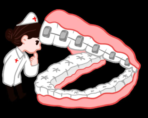 景德镇牙科12~15带自锁牙套费用差异解析