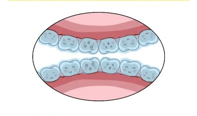 二、UC矫正器费用差异解析：为什么价格浮动大？