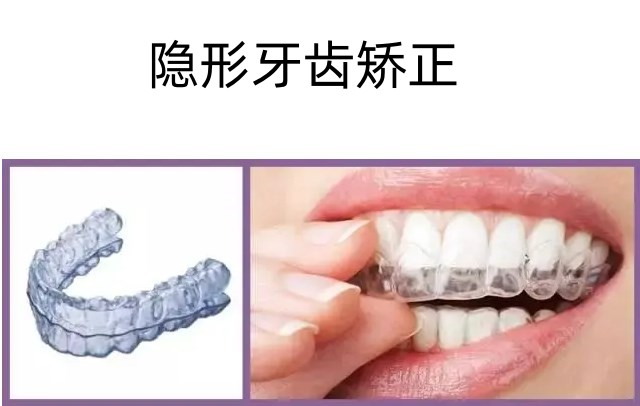 三、UC矫正器医院选择指南：3家高性价比机构推荐