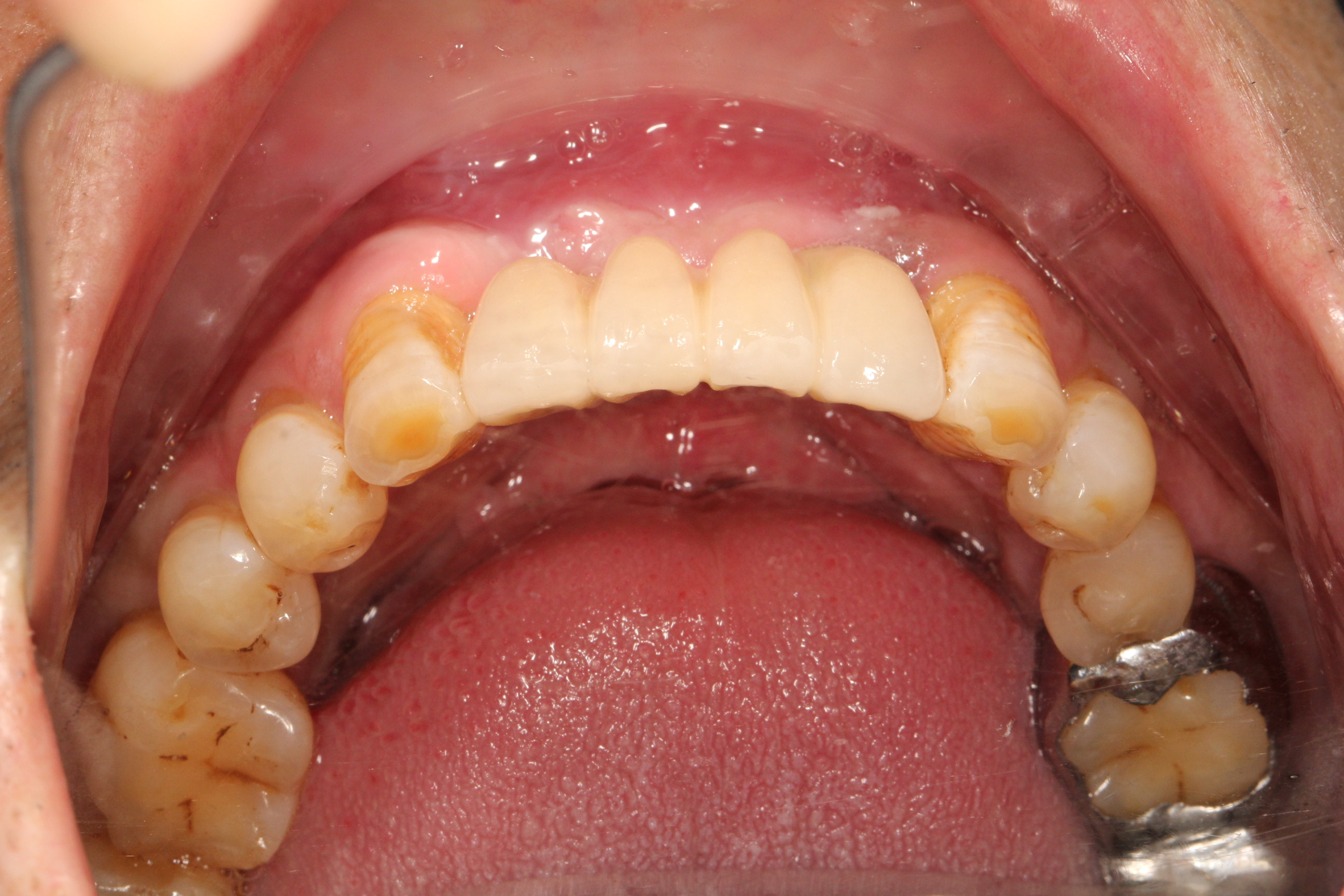 广州紫馨整形医院整牙可靠吗：医院资质与正规性分析