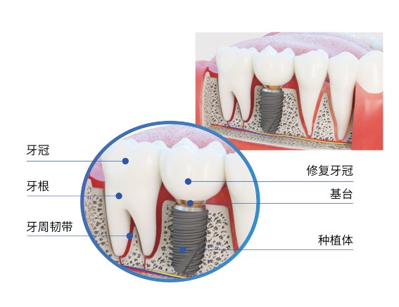 四、天津顺德口腔特色诊疗项目