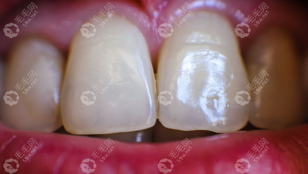 广州牙德堡口腔简介:含牙德堡口腔医生/价格/资质介绍