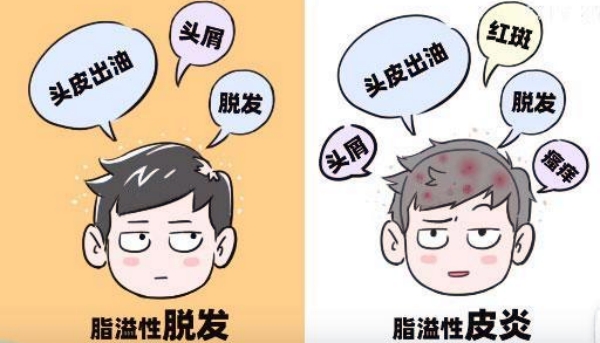 公主请查收：西安正规植发医院推荐前3，种发成活率更高些