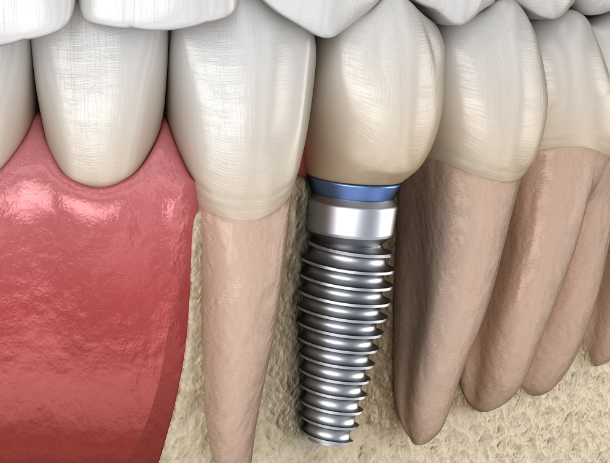 （三）亚萌口腔