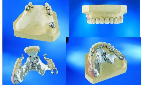 呼和浩特镶牙医院