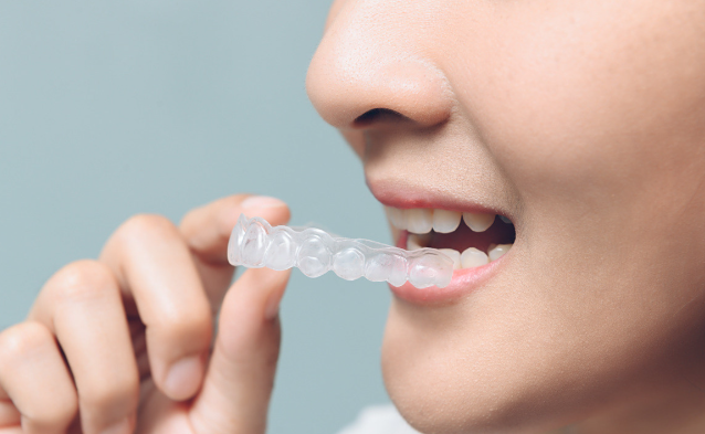 十大隐形牙套排行榜