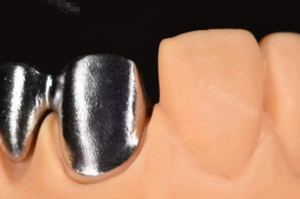 义佳微纳熔覆义齿与其他修复方式对比