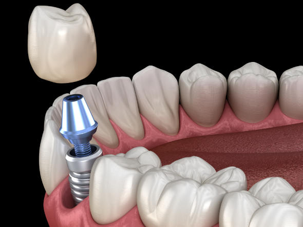 六、适合人群与注意事项