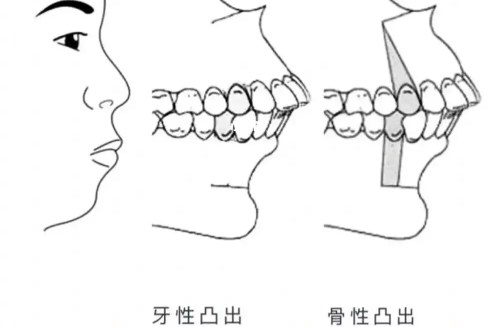 四、选择正畸医生的5个关键点www.59w.net