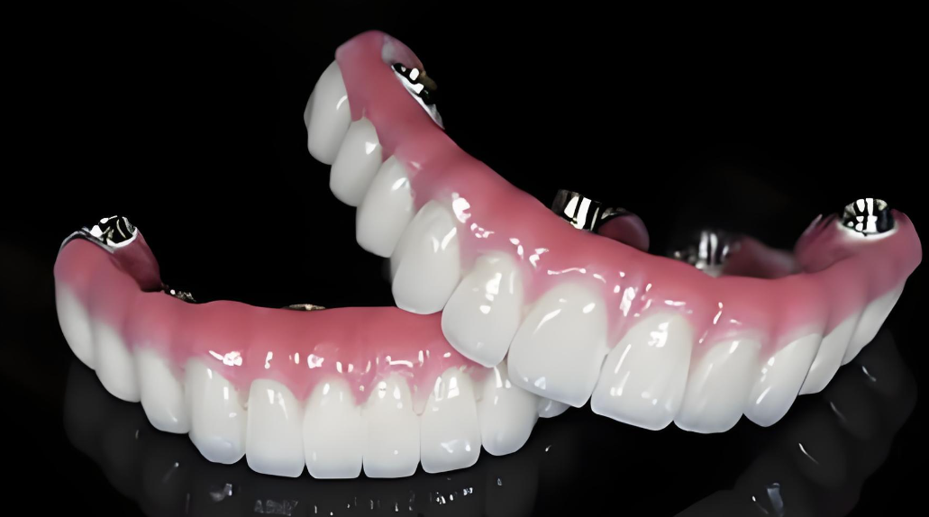 二、什么是马龙桥种植牙——与传统种植牙的区别www.59w.net