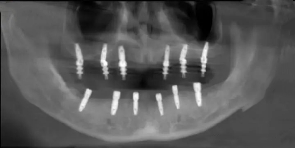 五、石门牙科发展趋势