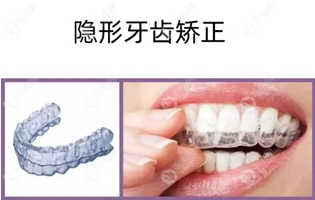 白天鹅口腔医院全瓷牙价格揭秘！爱尔创1800起威兰德2800元