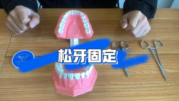 二、松牙固定术的治疗阶段和固定时长