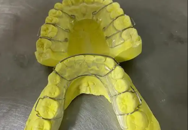 五、哈雷保持器和透明保持器舒适度和性能有什么区别？