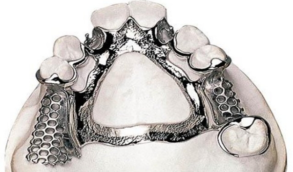 二、德国拜耳牙和松风塑钢牙品牌背景对假牙质量有何影响？