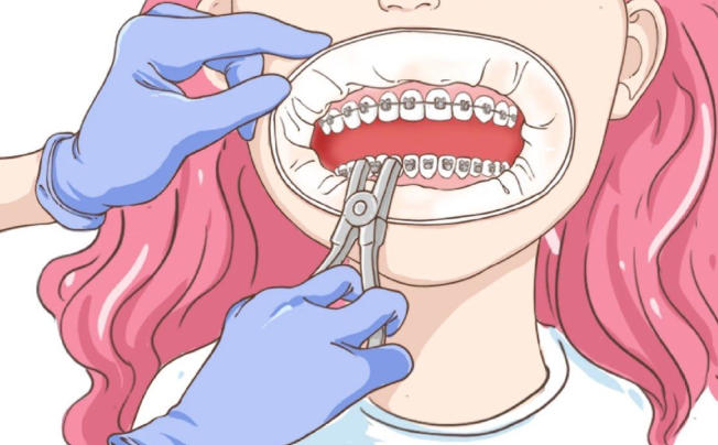 二、2025临床推荐的多区域位置选择