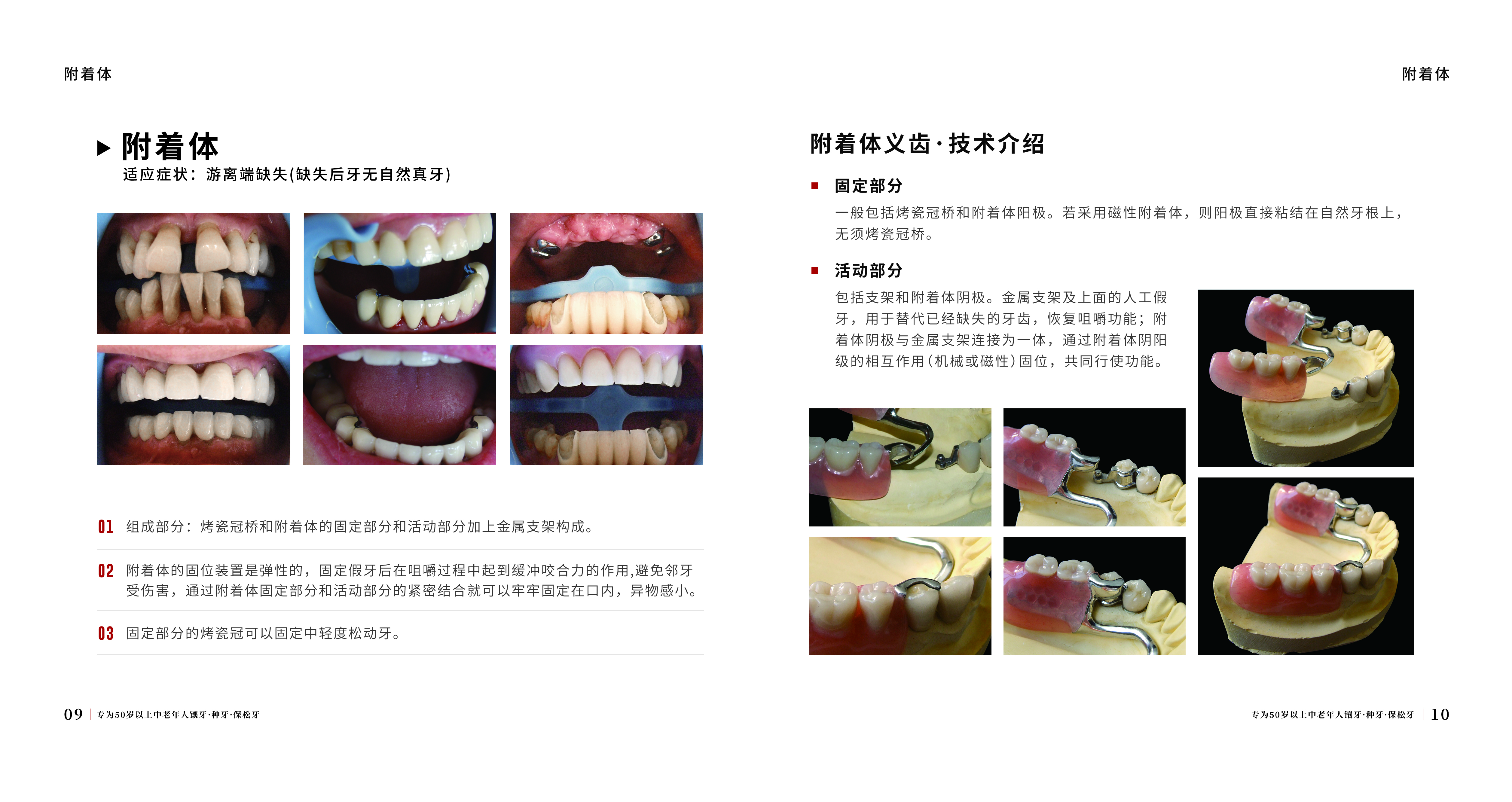 三、美冠塔口腔预约流程及技巧