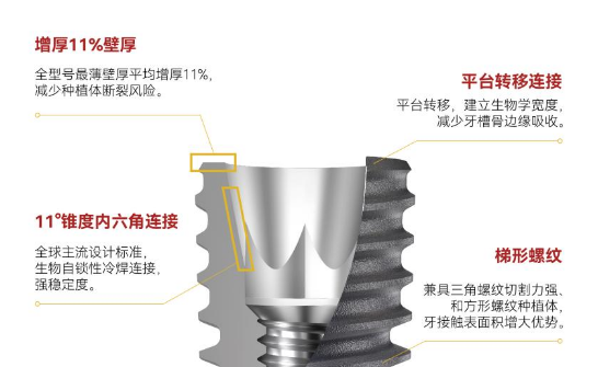 二、两种植体技术参数详细对比