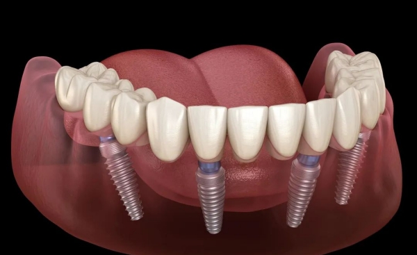 湛江柏乐口腔医院地址在哪里？赤坎/霞山两店位置、电话全揭秘