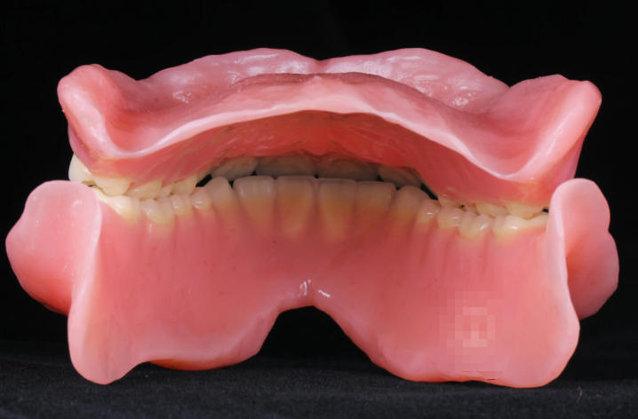 一、佛山吸附性义齿哪家医院可做——10家优质口腔机构推荐