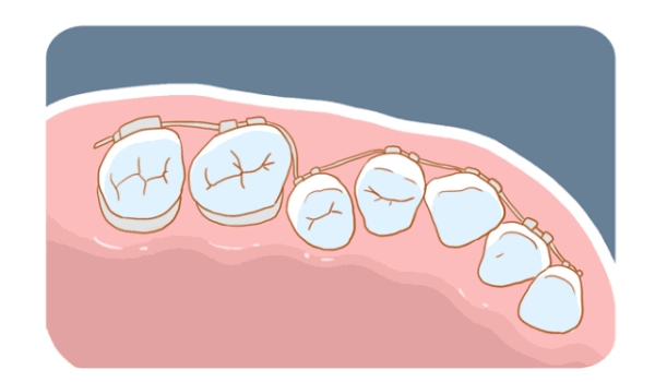 滕州牙博士口腔正畸