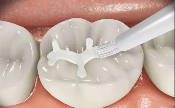 七、合肥佳德口腔(庐阳分院)