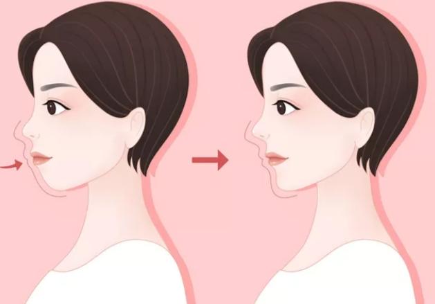 二、美国为什么不提倡做正颌手术？医疗理念差异是重要因素www.59w.net