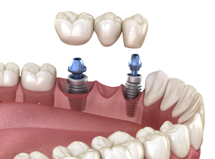 四、选择注意事项www.59w.net