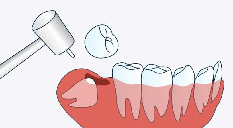 （三）政策报销须知